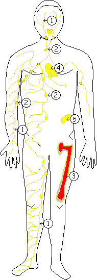 Übersicht Lymphsystem